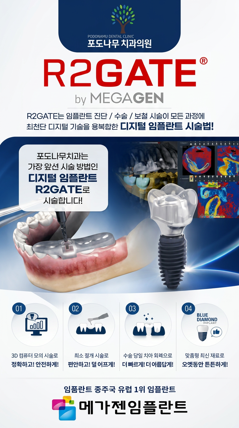 포도나무치과 R2GATE 디지털 임플란트